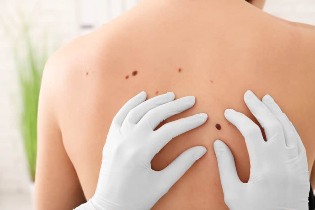 Oncologist examining patient during clinical visit, promoting early detection and raising awareness about cancer care and treatment